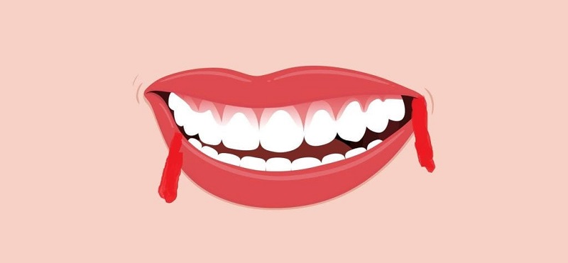 تفسير حلم خروج الدم من الفم