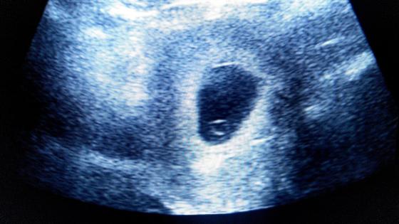 متى يتكون الجنين داخل كيس الحمل؟